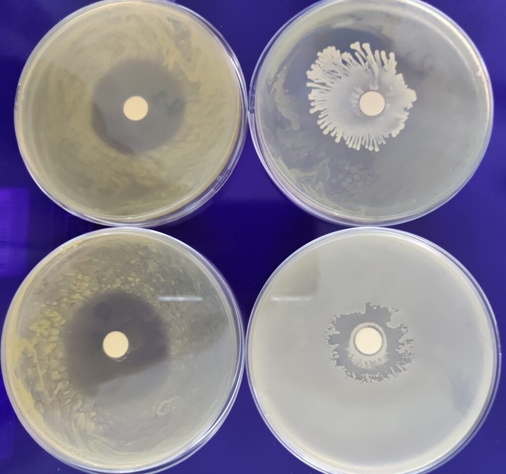 Halo de inhibición producidopor el antibiótico (izquierda) y el producido por la bacteria encontrada.